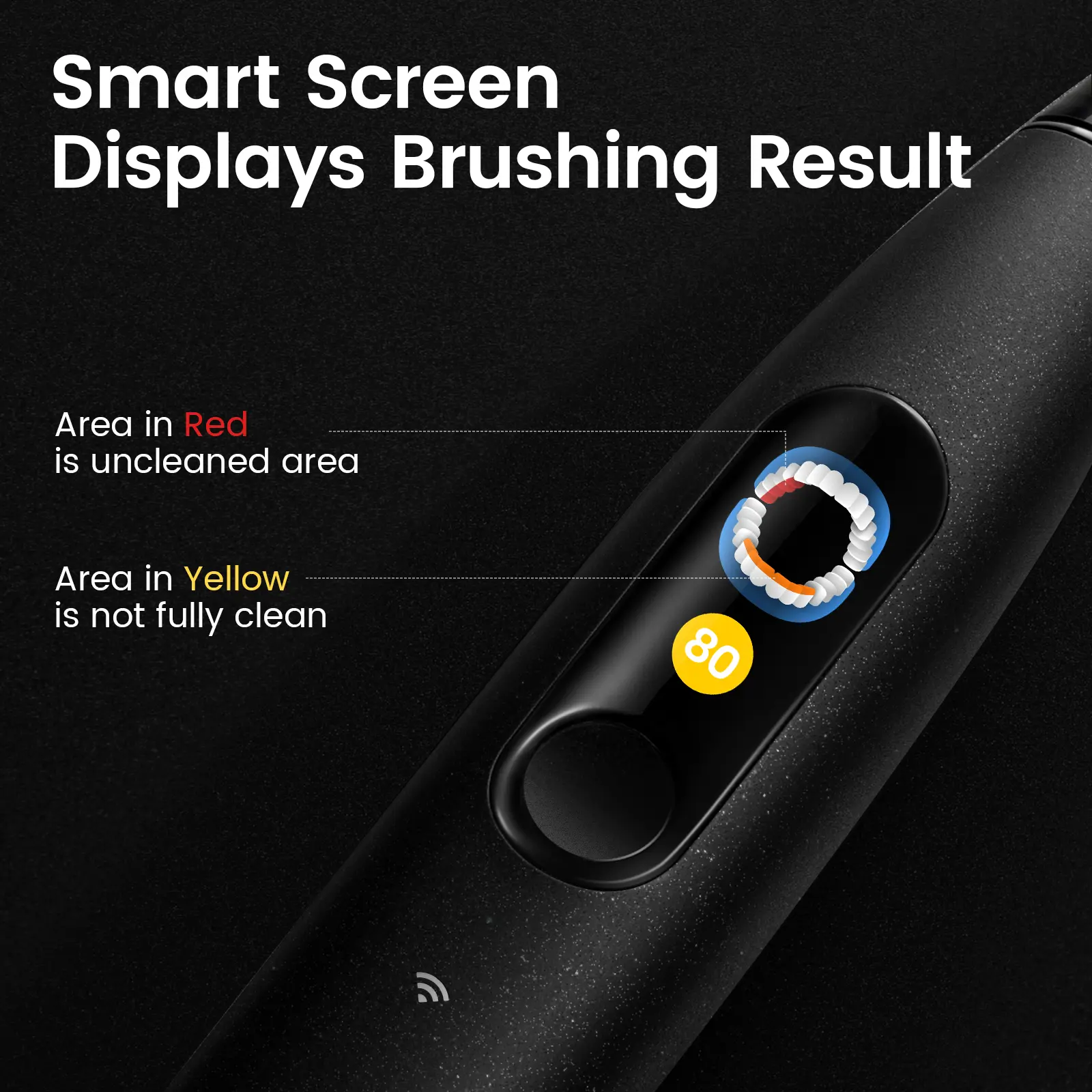 Oclean X Ultra 20 Sonic Toothbrush - Image 8